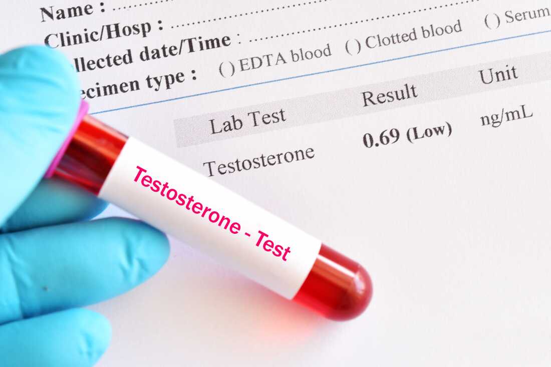 Understanding the Push for Testosterone Screening and Therapy