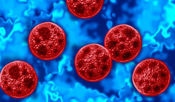 Cyclosporiasis Outbreak Escalates Across 41 States