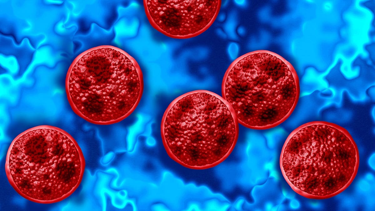 Cyclosporiasis Outbreak Escalates Across 41 States