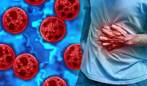 Cyclospora Outbreak: A Widespread Parasitic Challenge
