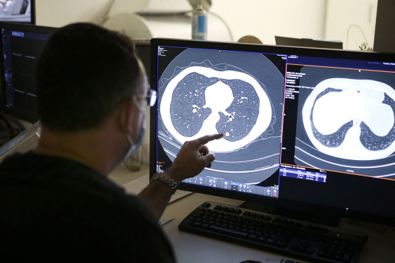 Promising Results in Lung Cancer Trial with Pancreatic Cancer Drug