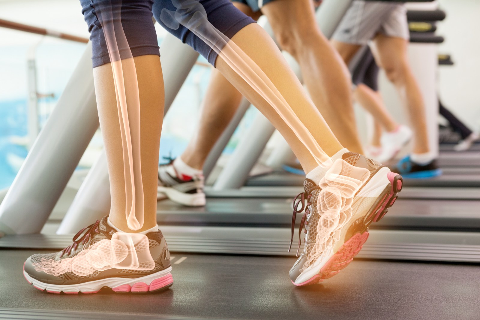 Common Habits That Affect Bone Health