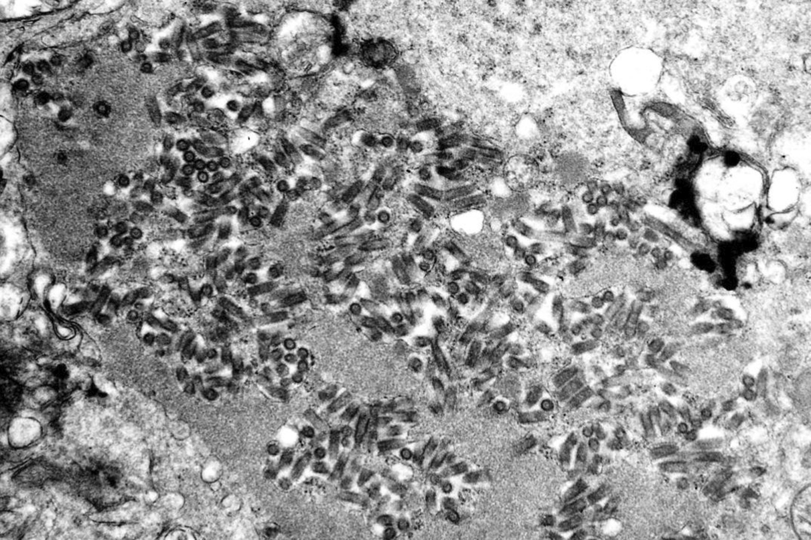 Rabies Warnings Issued in Multiple States After Infected Animals Detected