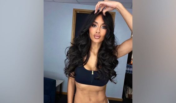 Nicole Scherzinger’s Resilience Amid Injury During Pussycat Dolls Tour