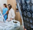 Increasing Stroke Risk Among Younger Adults: Insights and Prevention