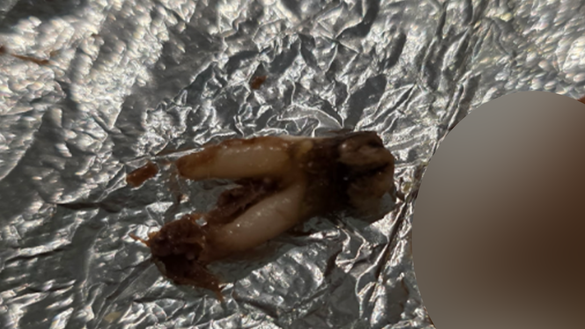 Texas Woman Finds Cow Tooth in Taco, Files Lawsuit Against Torchy’s Tacos