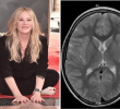 Christina Applegate Discusses Misdiagnosis of Multiple Sclerosis