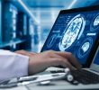 Study Finds Link Between Epilepsy and Early Dementia Risk