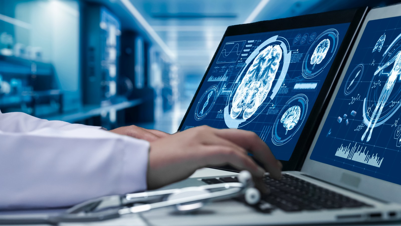 Study Finds Link Between Epilepsy and Early Dementia Risk