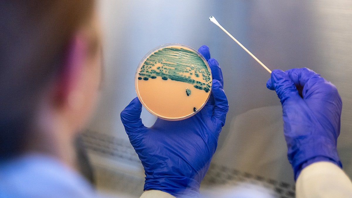 Rise of Antibiotic-Resistant Shigella Strains