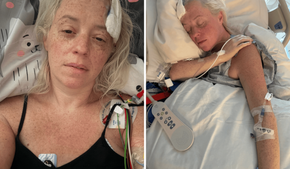Brain Aneurysm: Julie Nashawaty’s Unexpected Experience and Recovery Journey