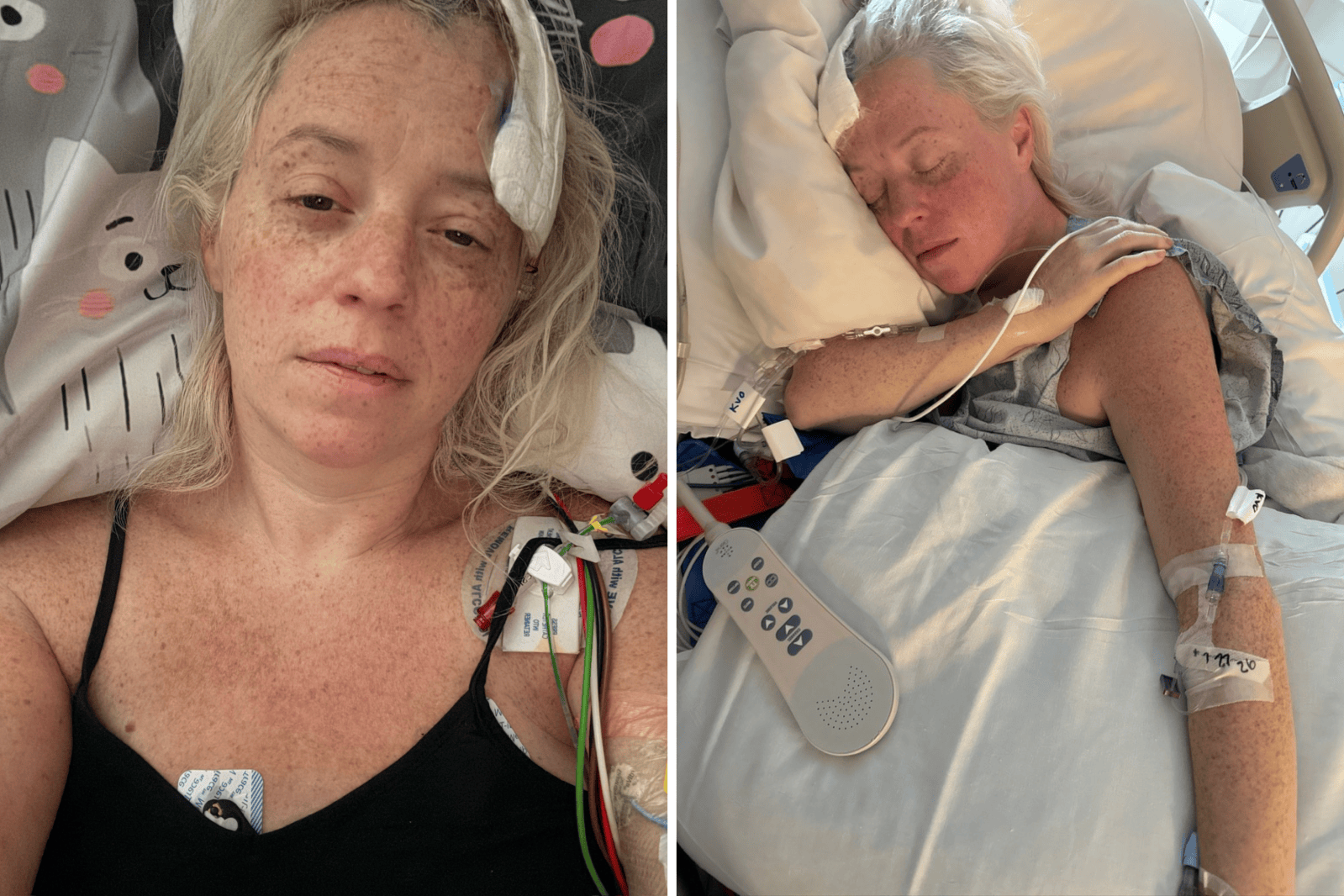 Brain Aneurysm: Julie Nashawaty’s Unexpected Experience and Recovery Journey